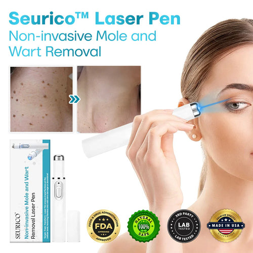 ✨Seurico™ Laser Pen - Non-invasive Mole and Wart Removal.
