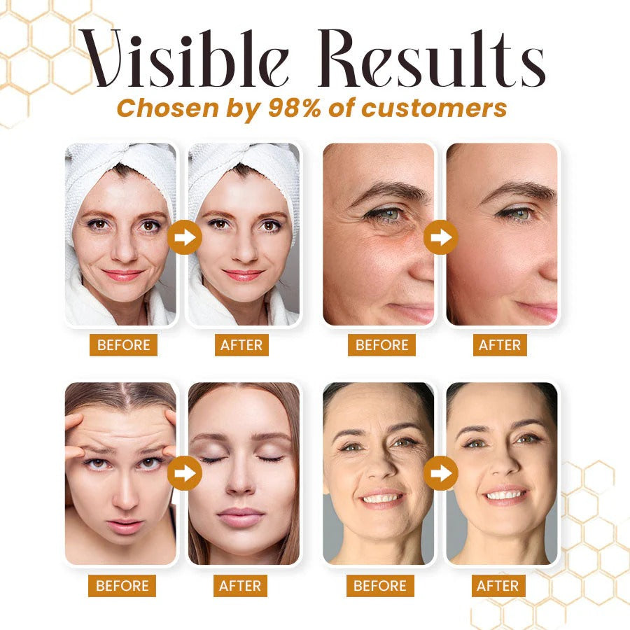 LBMLBM™ Botox Bee Venom Wrinkle Removal Cream – Look Younger in Days | 50% OFF Today Only ✅