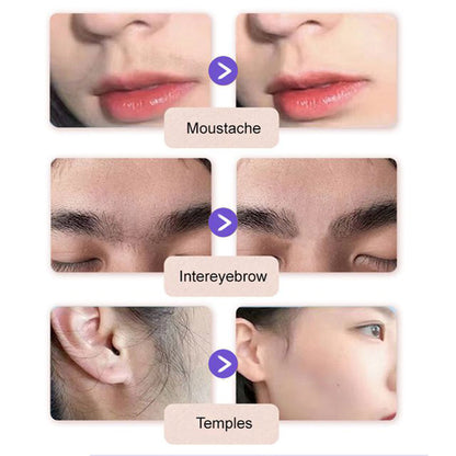 Negusy™ - Gentle and Painless Hair Removal Cream